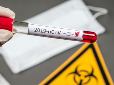 CRONACA – In Puglia 111 nuovi casi: in totale 786 i&nbsp;positivi